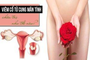 TRỊ VIÊM CỔ TỬ CUNG MÃN TÍNH NHƯ THẾ NÀO HIỆU QUẢ?