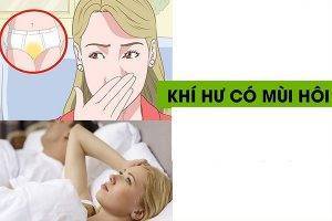 Cách hỗ trợ chữa khí hư có mùi hiệu quả dành cho chị em