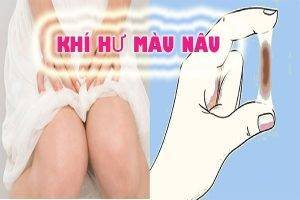 Khí hư màu nâu – Nỗi ám ảnh của chị em phụ nữ