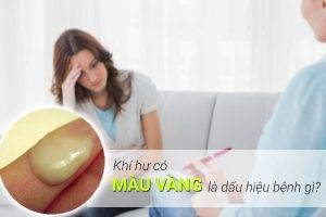 Khí hư ra nhiều có màu vàng là bệnh gì – Cách hỗ trợ điều trị ra sao?