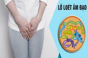 Lở loét âm đạo là bị bệnh gì?