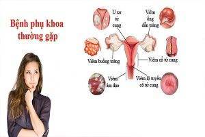 Bệnh phụ khoa là gì? Các dấu hiệu cần đi khám bệnh phụ khoa