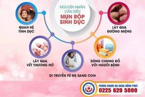 Cách hỗ trợ điều trị mụn rộp sinh dục hiệu quả