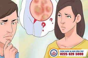 Mối nguy hiểm khôn lường ẩn sau những nốt mụn ở vùng kín