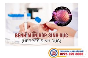 Nổi mụn ở dương vật, nguyên nhân và cách hỗ trợ điều trị