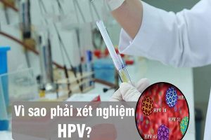 Xét nghiệm HPV chính xác tại TP.Vinh