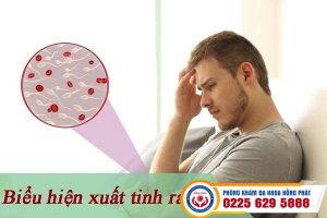 Xuất tinh ra máu – dấu hiệu cảnh báo nhiều căn bệnh nguy hiểm