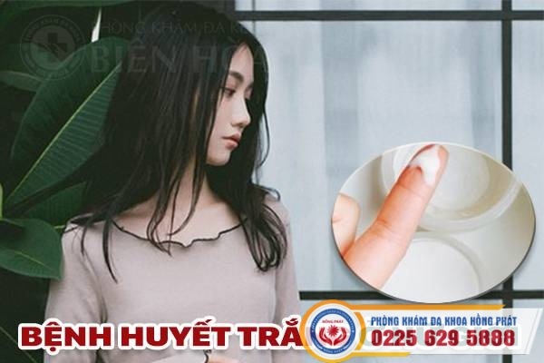 Bệnh huyết trắng ở nữ giới