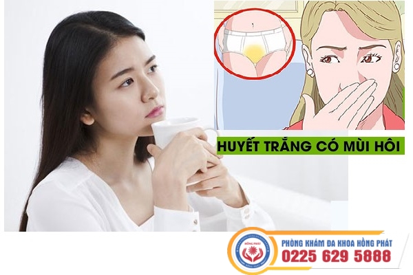 Huyết Trắng Có Mùi Hôi Là Dấu Hiệu Bệnh Gì?