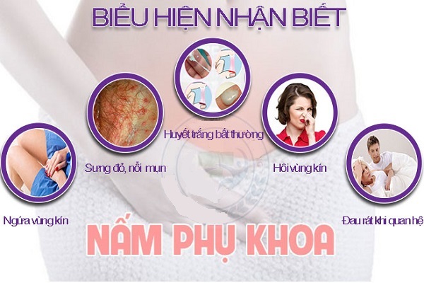 Tổng quan về bệnh nấm phụ khoa ở nữ giới