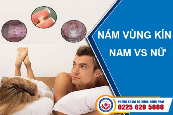 Tìm hiểu về bệnh nấm vùng kín ở nữ giới