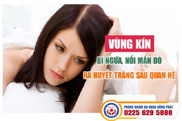 Ngứa Rát Vùng Kín Và Những Điều Chị Em Cần Biết