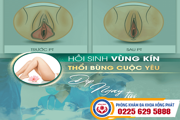 Cắt Mép Vùng Kín Giá Bao Nhiêu? Chuyên Khoa Thẩm Mỹ Uy Tín Ở Đâu Tại Hải Phòng?