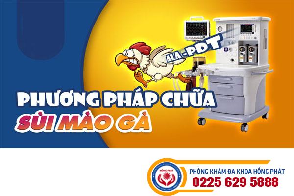 Phương pháp ala-pdt là gì?