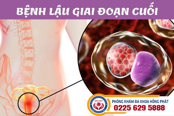 Lậu giai đoạn cuối và những triệu chứng nguy hiểm