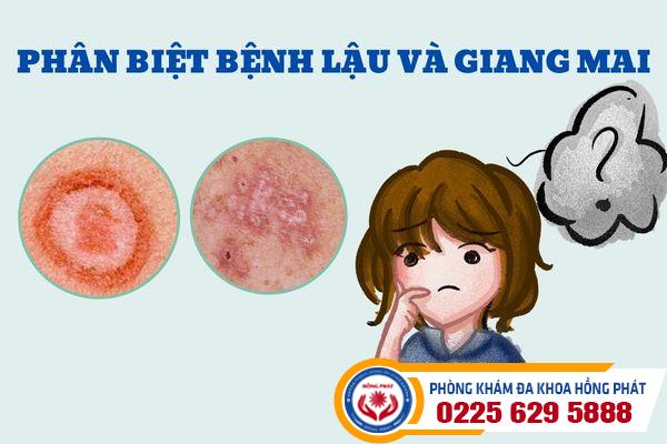 Dấu hiệu bệnh lậu bệnh giang mai mà bạn cần biết