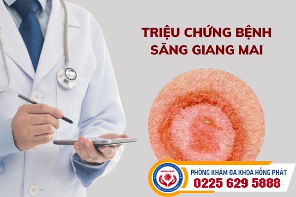 Những triệu chứng bệnh săng giang mai