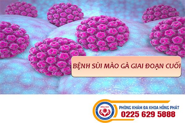 Dấu hiệu bệnh sùi mào gà giai đoạn cuối