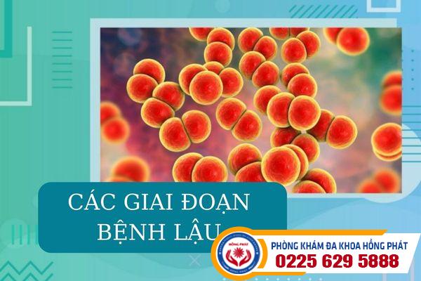 Tìm hiểu về các giai đoạn bệnh lậu