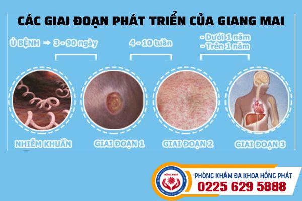 Chữa giang mai như thế nào hiệu quả?