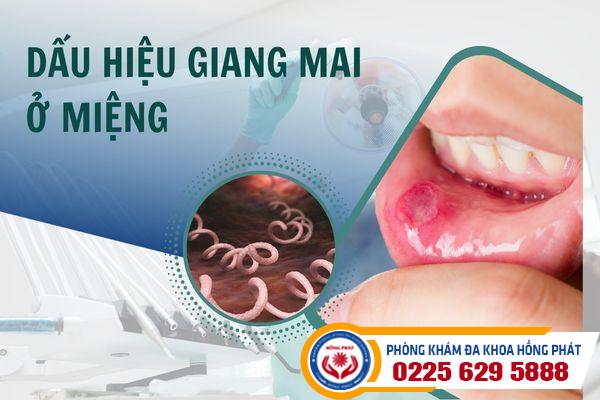 Những dấu hiệu giang mai miệng mà bạn cần biết