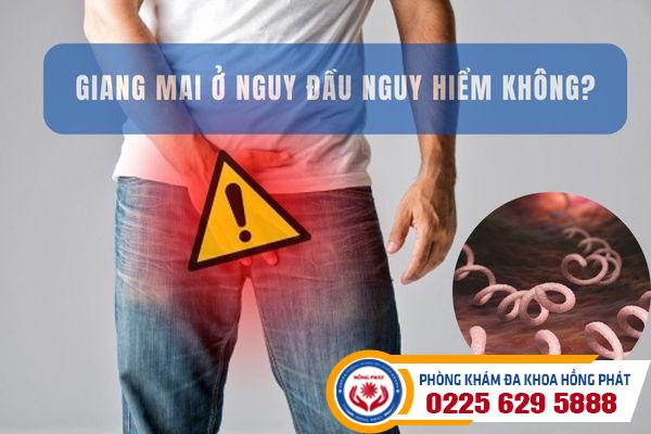 Giang mai ở quy đầu và những hệ lụy khó lường