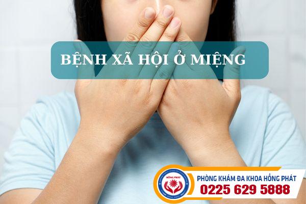 Tìm hiểu về những căn bệnh xã hội ở miệng