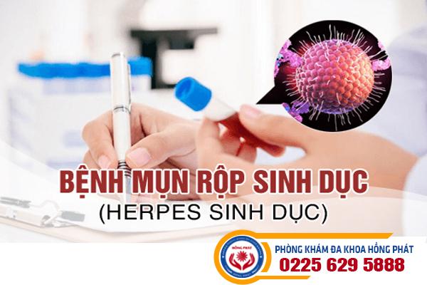 Chi phí điều trị mụn rộp sinh dục bao nhiêu?