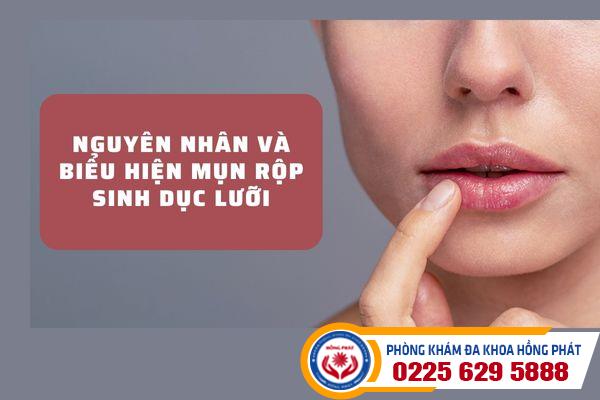 Nguyên nhân và biểu hiện mụn rộp sinh dục lưỡi