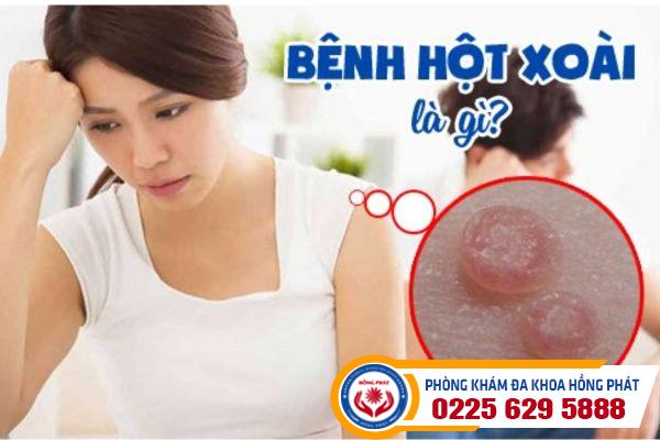 Bệnh hột xoài là gì? Cách điều trị bệnh hiệu quả