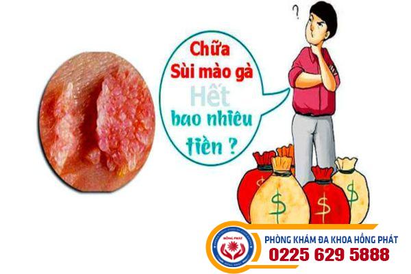 Chi phí trị sùi mào gà hiện nay là bao nhiêu?