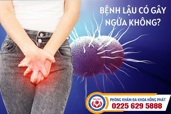 Bệnh lậu có gây ngứa không?