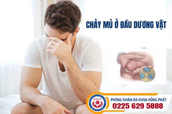 Chảy mủ ở dương vật và những nguyên nhân bệnh lý