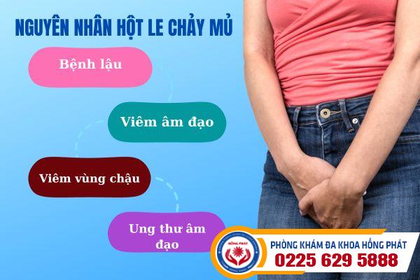 Hột le chảy mủ và những nguyên nhân bệnh lý