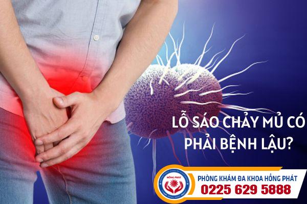 Lỗ sáo chảy mủ có phải là bị bệnh lậu?