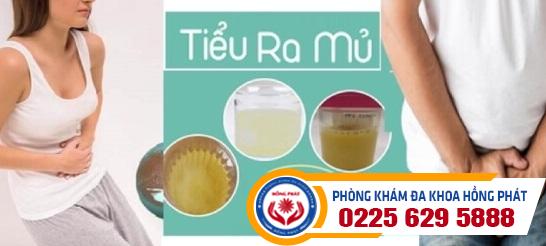 Tiểu có mủ và những nguyên nhân thường gặp