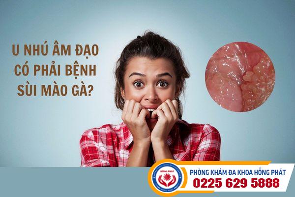 U nhú âm đạo có phải là bệnh sùi mào gà?