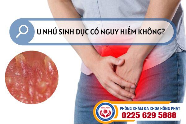 U nhú sinh dục có nguy hiểm không?