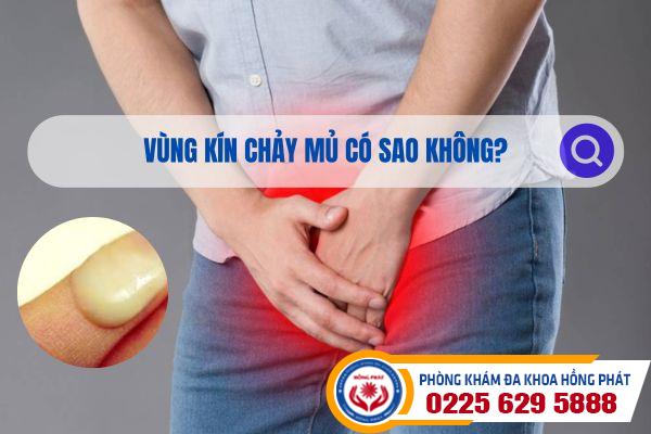 Vùng kín chảy mủ có sao không?