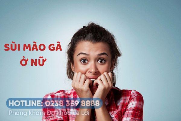 Tư vấn cách trị bệnh sùi mào gà ở nữ nhanh chóng và hiệu quả