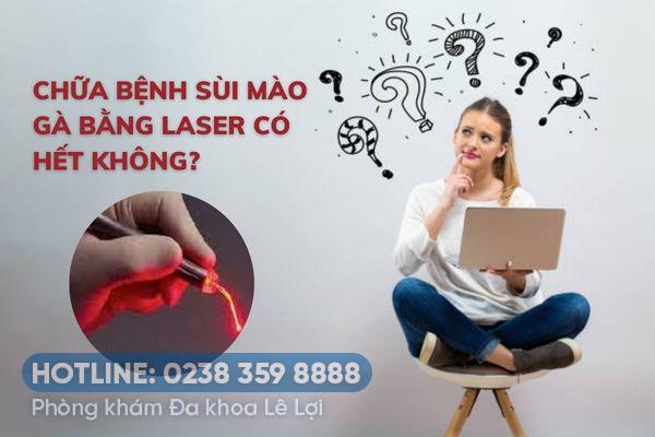 Điều trị sùi mào gà bằng Laser CO2 có hiệu quả không?