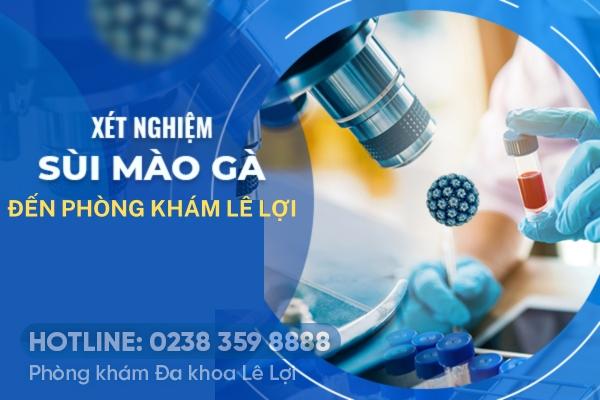 Địa điểm xét nghiệm sùi mào gà uy tín, chính xác