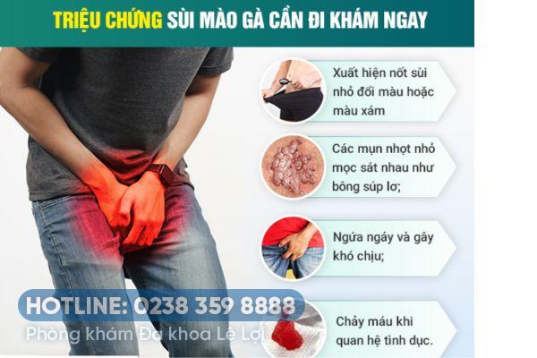 Một số dấu hiệu đầu tiên sùi mào gà giai đoạn đầu ở nam giới