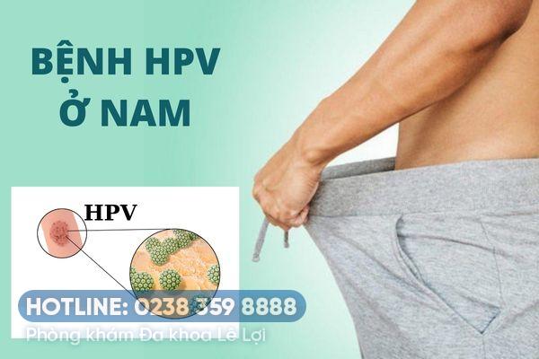 Bệnh HPV ở nam và cách điều trị hiệu quả