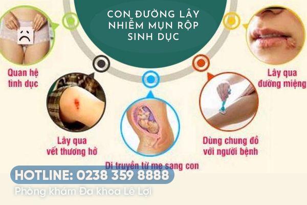 [Giải đáp]: Mụn rộp lan nhanh không?