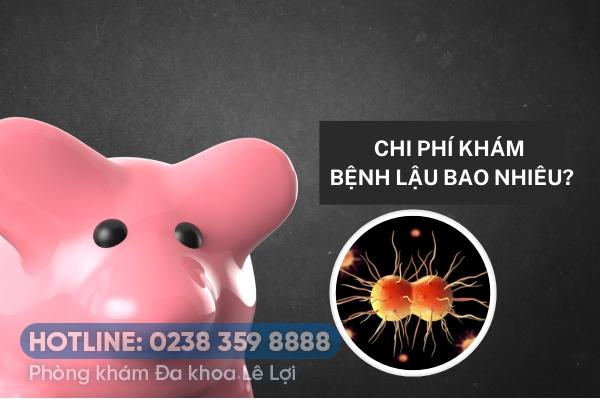 Chi phí khám bệnh lậu bao nhiêu?