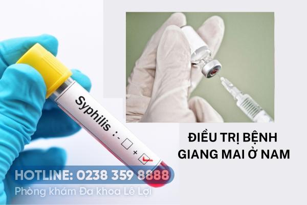 Điều trị bệnh giang mai ở nam thế nào?