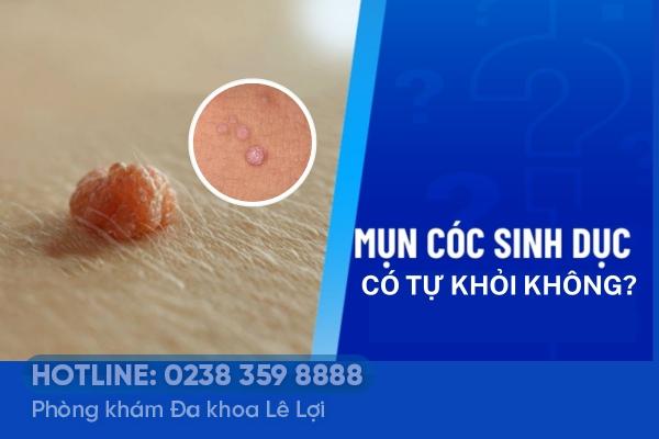 Mụn cóc sinh dục có tự khỏi không?