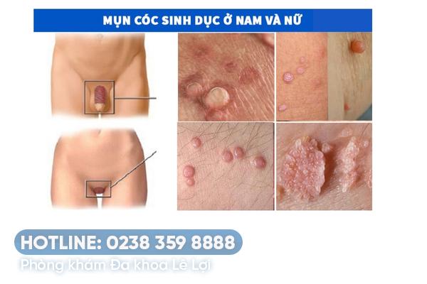 mun-coc-sinh-duc-nam-nu