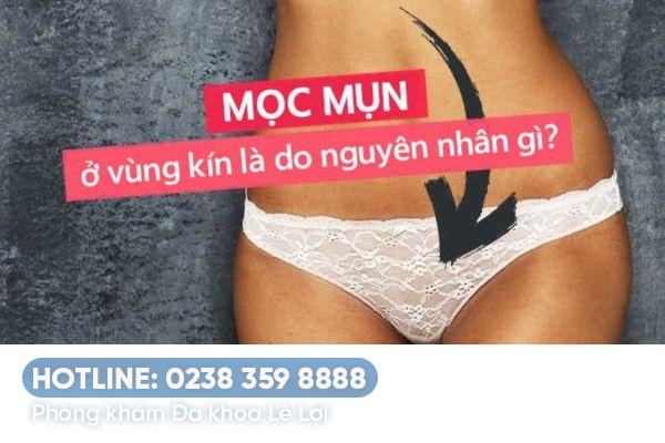 Nơi trị mụn trắng ở vùng kín nữ hiệu quả